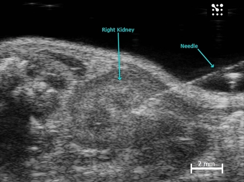 Image Guided Injection Into The Mouse Kidney | FUJIFILM VisualSonics